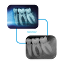 Acteon PSPIX 2 Digital Imaging Plate Scanner PSP