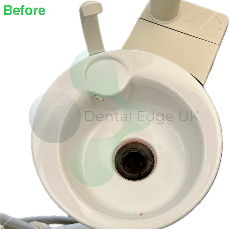 DCI 5313 Universal Grey Cuspidor Spittoon Screen Filter 2 1/2" - Dental Edge UK