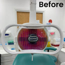 Dental Edge UK -  Dental Edge UK Belmont 048 Operating Light LED Upgrade Kit