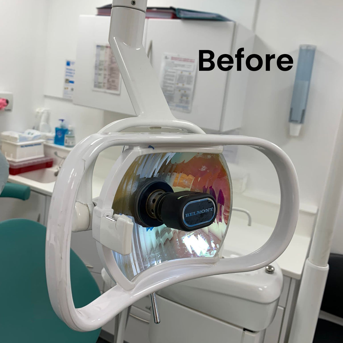 BONEW Dental LED Oral Light - Shadowless Lamp For Dental Chair, 22mm Joint, Adjustable Illumination
