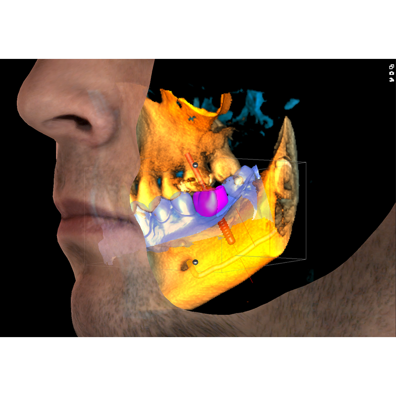 Planmeca ProMax® 3D Classic CBCT - Dental Edge UK