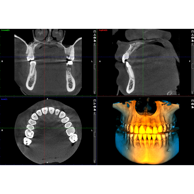 Planmeca ProMax® 3D Classic CBCT - Dental Edge UK