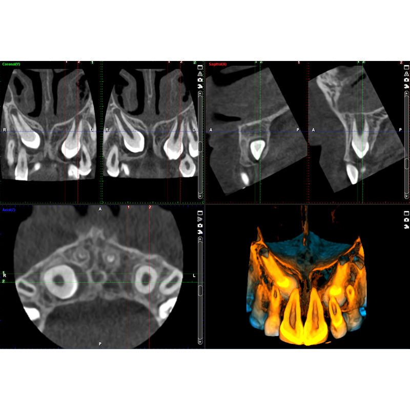 Planmeca ProMax® 3D Classic CBCT - Dental Edge UK