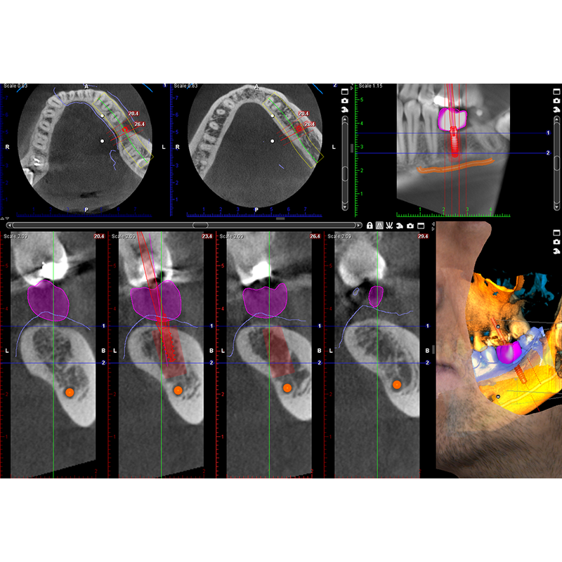 Planmeca ProMax® 3D Classic CBCT - Dental Edge UK