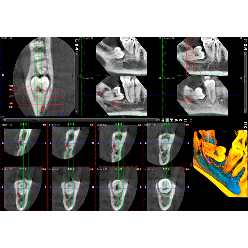 Planmeca ProMax® 3D Classic CBCT - Dental Edge UK